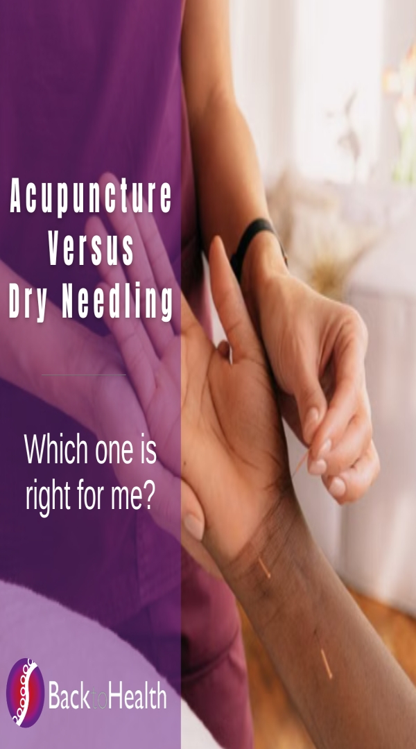 Dry Needling vs Acupuncture: What's the Difference?
